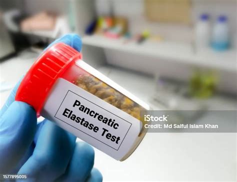 Fecal elastase, an assay for exocrine pancreatic insufficiency, has ...